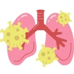 Pneumonia Treatment by Best General Physician in Ravet