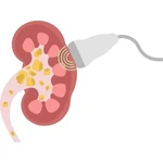 Renal & Liver Biopsy in Punawale near Tathawade