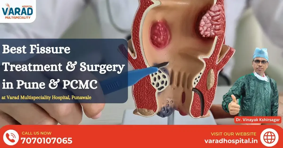 Best Fissure Treatment & Surgery in Pune & PCMC