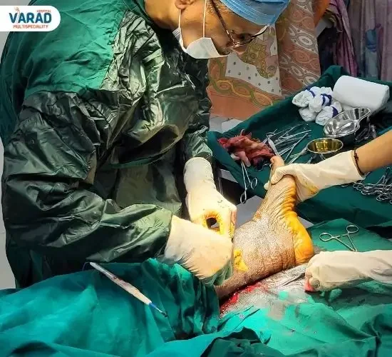 Live General Surgery by Dr. Vinayak Kshirsagar