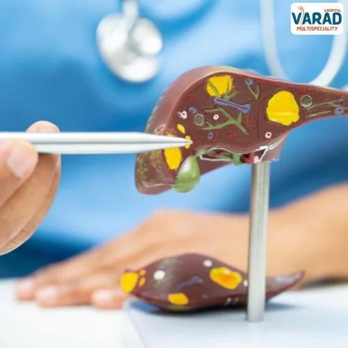 Cholecystectomy PPT – Download Free – Dr. Vinayak Kshirsagar in Pune Cholecystectomy PPT - Download Free - Dr. Vinayak Kshirsagar in Pune