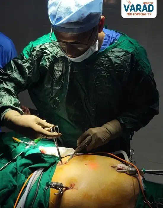 Cholecystectomy Surgery in Pune by Dr Vinayak Kshirsagar - Laparoscopic Gallbladder Surgery