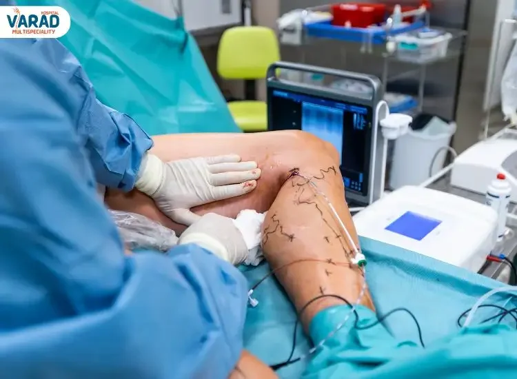 Cost of Varicose veins surgery in Pune Cost of Varicose veins surgery in Pune