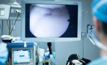 Diagnostic Arthroscopy by by Top Arthroscopic Surgeon in PCMC