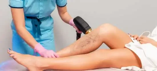 Laser Treatment - Varicose Vein Treatment in Pune