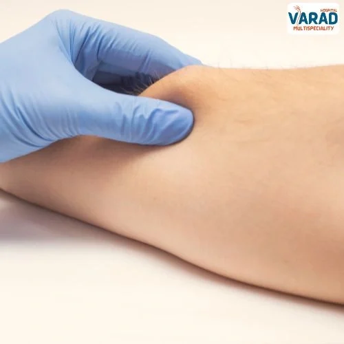 Lipoma Removal cost in Pune – Varad Multispeciality Hospital, Punawale Lipoma Removal cost in Pune - Varad Multispeciality Hospital, Punawale