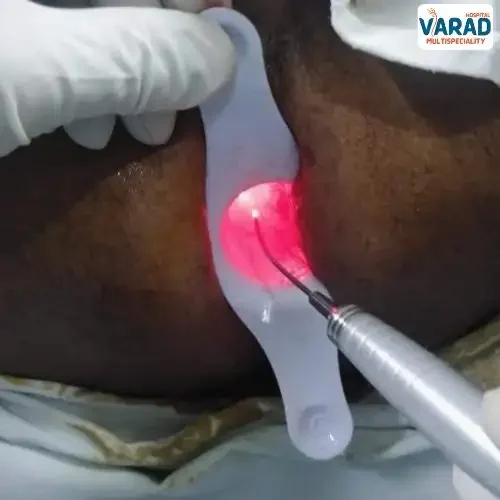 Piles Operation Cost in Pune – Explained by Best Piles Doctor in Pune Dr. Vinayak Kshirsagar Piles Operation Cost in Pune - Explained by Best Piles Doctor in Pune Dr. Vinayak Kshirsagar