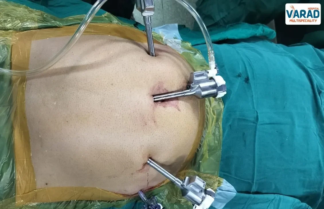 Robotic Surgeries in Pune by Dr. Vinayak Kshirsagar