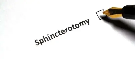 Sphincterotomy Surgery at Top Hospital for Anal Fissure treatment in Pune